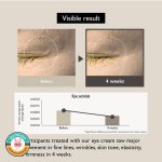 کرم دور چشم باکوچیول و برنج سیاه هارو هارو واندر 20 میل - Image 2