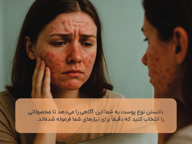 مراقبت از پوست چرب و مستعد جوش