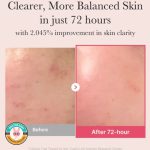 سرم ضد لک و روشن کننده ترانگزامیک اسید و نیاسینامید 15% مدی کیوب - Image 4